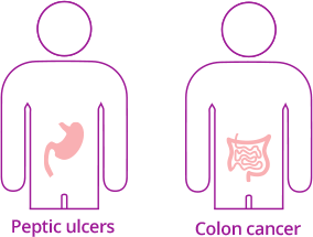 Diagram displaying GI bleeding can be caused by conditions such as Peptic ulcers and Colon cancer